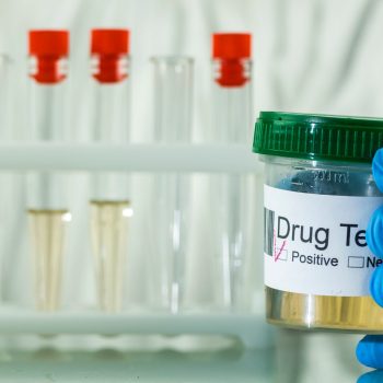Analysis of urine with a positive result on doping, the lab technician makes a mark in pencil.